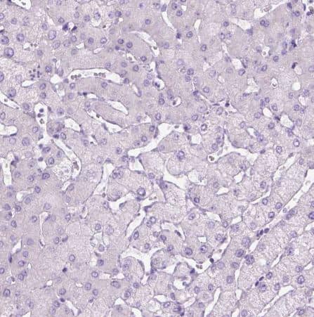 Staining of human liver shows no positivity in hepatocytes as expected.