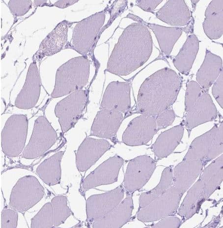 Staining of human skeletal muscle shows no positivity  in myocytes as expected. 