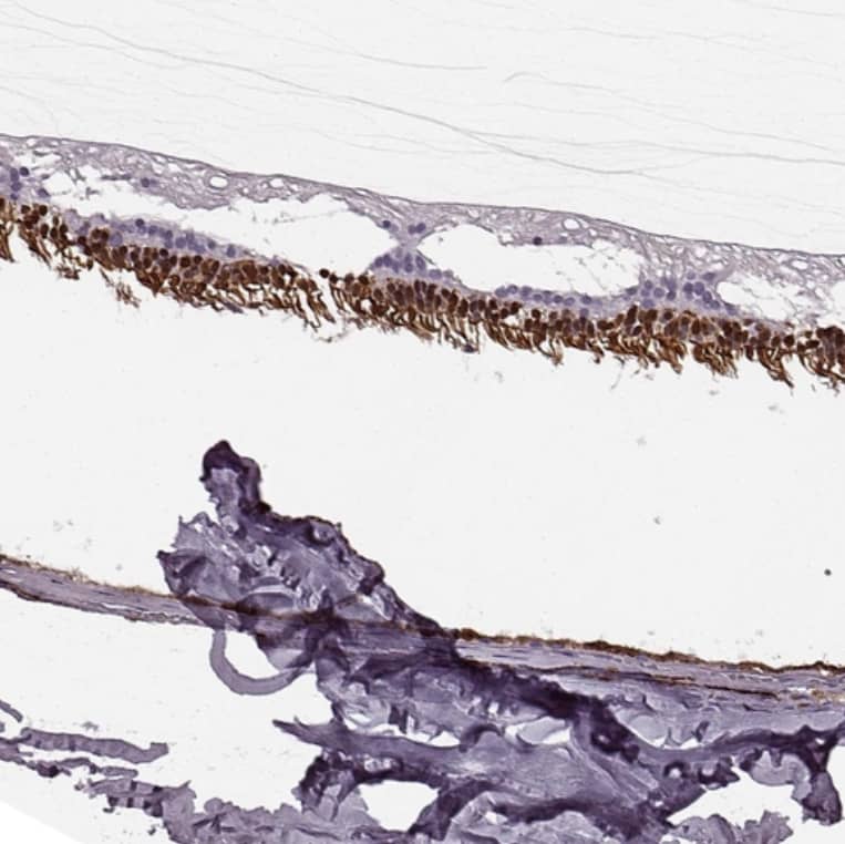 Staining of human eye, retina shows strong cytoplasmic-nuclear positivity in photoreceptor cells.