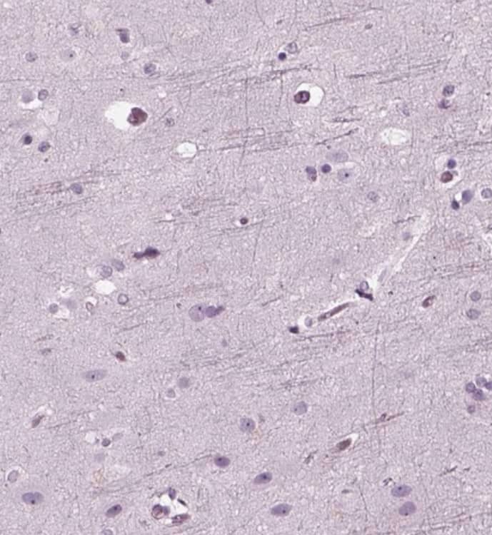 Staining of human cerebral cortex shows weak nucleus positivity in glial cells.