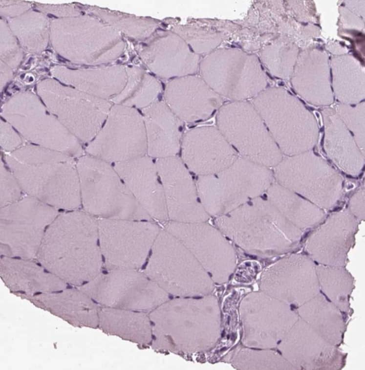 Staining of human skeletal muscle shows no positivity in myocytes as expected.