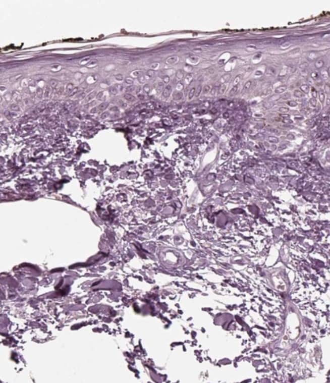 Staining of human skin shows no positivity in squamous epithelial cells as expected.