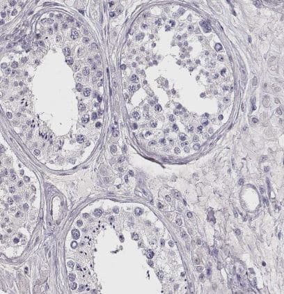 Immunohistochemistry-Paraffin VMAT1/SLC18A1 Antibody