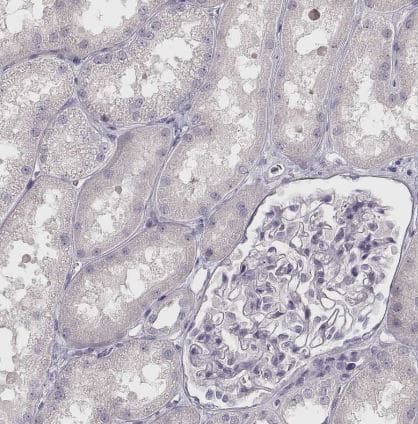 Immunohistochemistry-Paraffin: VMAT1/SLC18A1 Antibody [NBP2-58895] -Staining of human kidney shows no positivity in cells in tubules as expected.