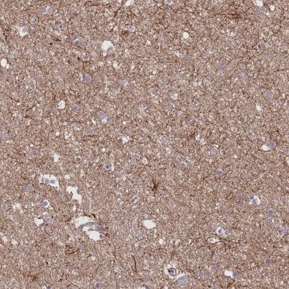 Immunohistochemistry-Paraffin: G protein alpha inhibitor 1 Antibody [NBP2-59000] -Staining of human cerebral cortex shows moderate membranous-cytoplasmic positivity in neuropil and astrocytes.