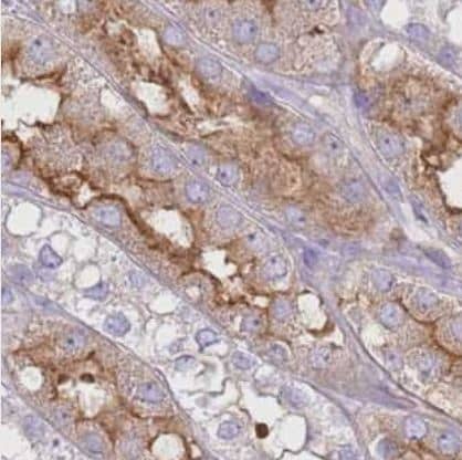 Immunohistochemistry-Paraffin: G protein alpha inhibitor 1 Antibody [NBP2-59000] -Staining of human kidney shows strong membranous-cytoplasmic positivity in cells in tubules.