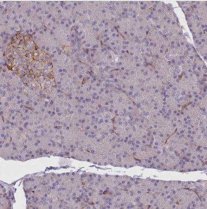 Immunohistochemistry-Paraffin: G protein alpha inhibitor 1 Antibody [NBP2-59000] -Staining of human pancreas shows moderate membranous/cytoplasmic positivity in endocrine glandular cells.