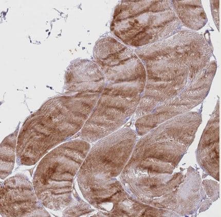 Immunohistochemistry-Paraffin: G protein alpha inhibitor 1 Antibody [NBP2-59000] - Staining of human skeletal muscle shows moderate cytoplasmic positivity in myocytes.