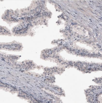 Immunohistochemistry-Paraffin: FoxJ1/HFH4 Antibody [NBP2-59033] -Staining of human prostate shows no positivity in glandular cells as expected.
