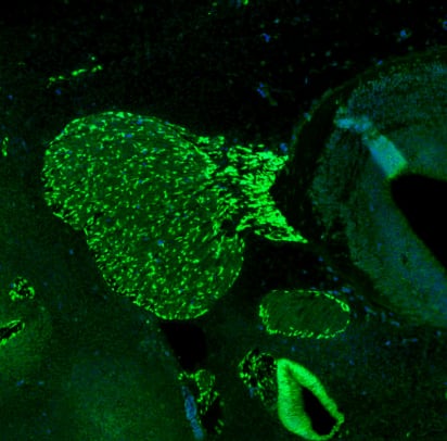 Staining of mouse embryo E11 shows strong positivity in the developing trigeminal ganglion.