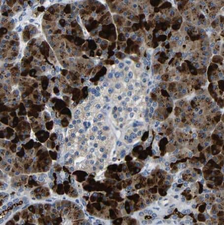  Dcp1a Antibody [NBP2-59785] - Staining of human pancreas shows moderate to strong cytoplasmic positivity in exocrine glandular cells.