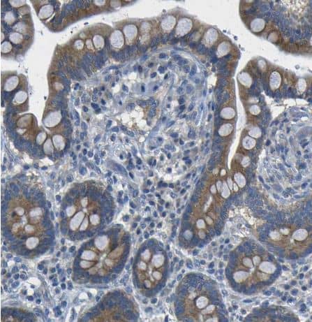 Dcp1a Antibody [NBP2-59785] - Staining of human colon shows moderate cytoplasmic positivity in glandular cells.