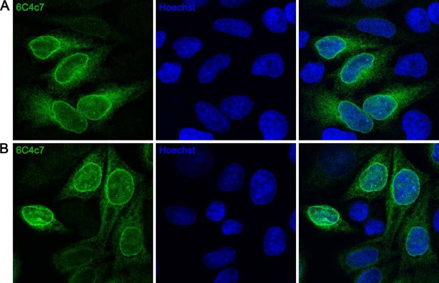 Immunocytochemistry/Immunofluorescence: BirA Antibody (6C4c7) [NBP2-59938] - HeLa cells stably expressing a BirA tagged TorsinAE171Q were fixed in (A) 4% PFA or (B) cold methanol and stained with anti-BirA 6C4c7 monoclonal antibody (green). The nuclei were counter-stained with Hoechst.