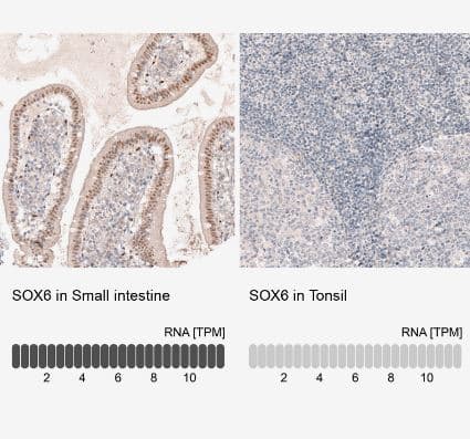 Immunohistochemistry-Paraffin: SOX6 Antibody (CL5690) [NBP2-61423] - Analysis in human small intestine and tonsil tissues using NBP2-61423 antibody. Corresponding SOX6 RNA-seq data are presented for the same tissues.