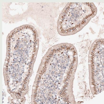 Immunohistochemistry-Paraffin: SOX6 Antibody (CL5690) [NBP2-61423] - Staining of human small intestine shows moderate nuclear positivity in glandular cells.