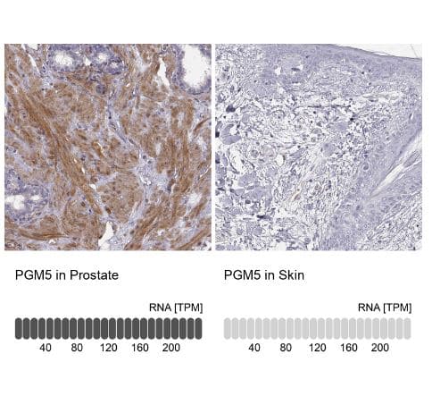 Immunohistochemistry-Paraffin Phosphoglucomutase 5 Antibody - BSA Free