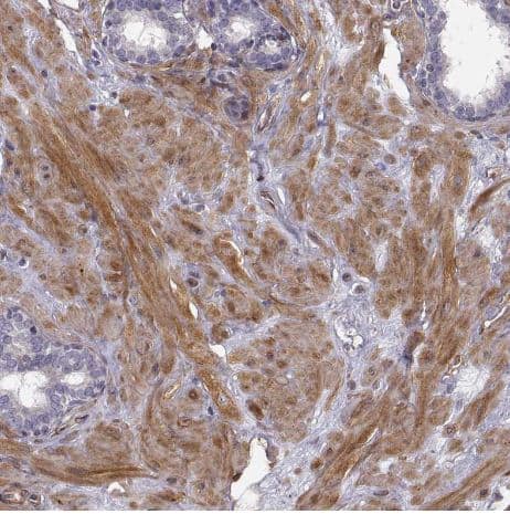 Immunohistochemistry-Paraffin: Phosphoglucomutase 5 Antibody [NBP2-62654] -Staining of human prostate shows moderate cytoplasmic positivity in smooth muscle cells.