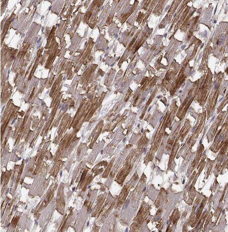 Immunohistochemistry-Paraffin: Phosphoglucomutase 5 Antibody [NBP2-62654] -Staining of human heart muscle shows strong cytoplasmic positivity in cardiomyocytes.