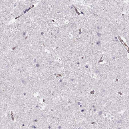 Immunohistochemistry-Paraffin: Phosphoglucomutase 5 Antibody [NBP2-62654] -Staining of human cerebral cortex shows weak cytoplasmic positivity in endothelial cells.