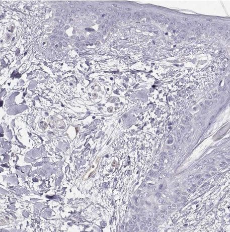 Immunohistochemistry-Paraffin: Phosphoglucomutase 5 Antibody [NBP2-62654] -Staining of human skin shows negative positivity in squamous epithelial cells as expected.