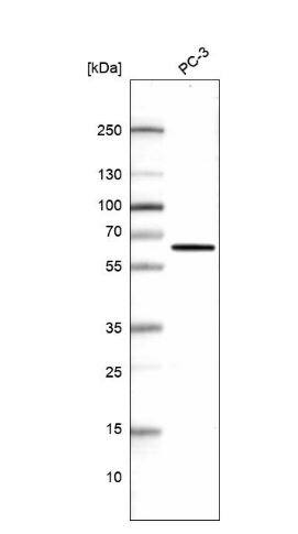 <b>Orthogonal Strategies Validation. </b>Western Blot: Phosphoglucomutase 5 Antibody [NBP2-62654] -Analysis in human cell line PC-3.