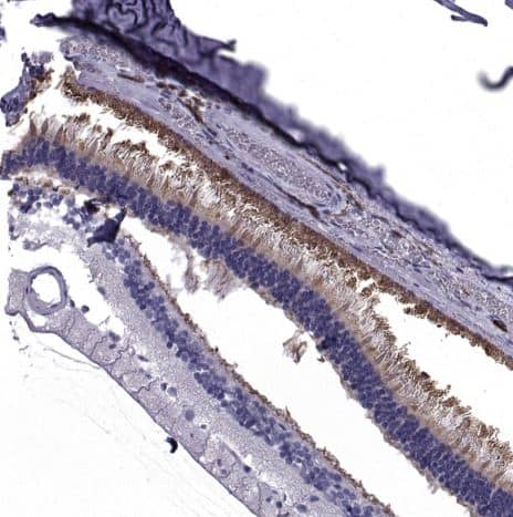 Immunohistochemistry-Paraffin PDE6H Antibody