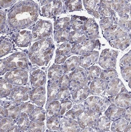 Immunohistochemistry-Paraffin PDE6H Antibody