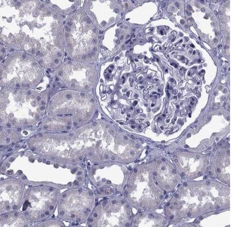 Immunohistochemistry-Paraffin PDE6H Antibody