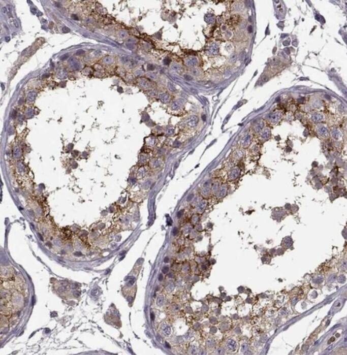 Staining of human testis shows strong cytoplasmic positivity in cells in seminiferous ducts