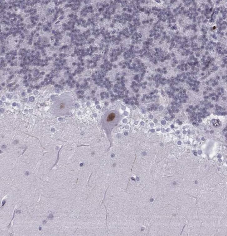 Staining of human cerebellum shows strong nuclear positivity in Purkinje cells.