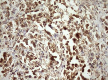 Immunohistochemistry-Paraffin-MRG15 Antibody (OTI5D2) - Azide and BSA Free [NBP2-72778] - Human bladder tissue within the normal limits using anti-MORF4L1 mouse monoclonal antibody. (Heat-induced epitope retrieval by Tris-EDTA, pH8.0.