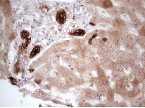 PHGDH Antibody (OTI5C4) - Azide and BSA Free [NBP2-73372] -Human liver tissue within the normal limits using anti-PHGDH mouse monoclonal antibody. (Heat-induced epitope retrieval by 1mM EDTA in 10mM Tris, pH8.5, 120 C for 3min.