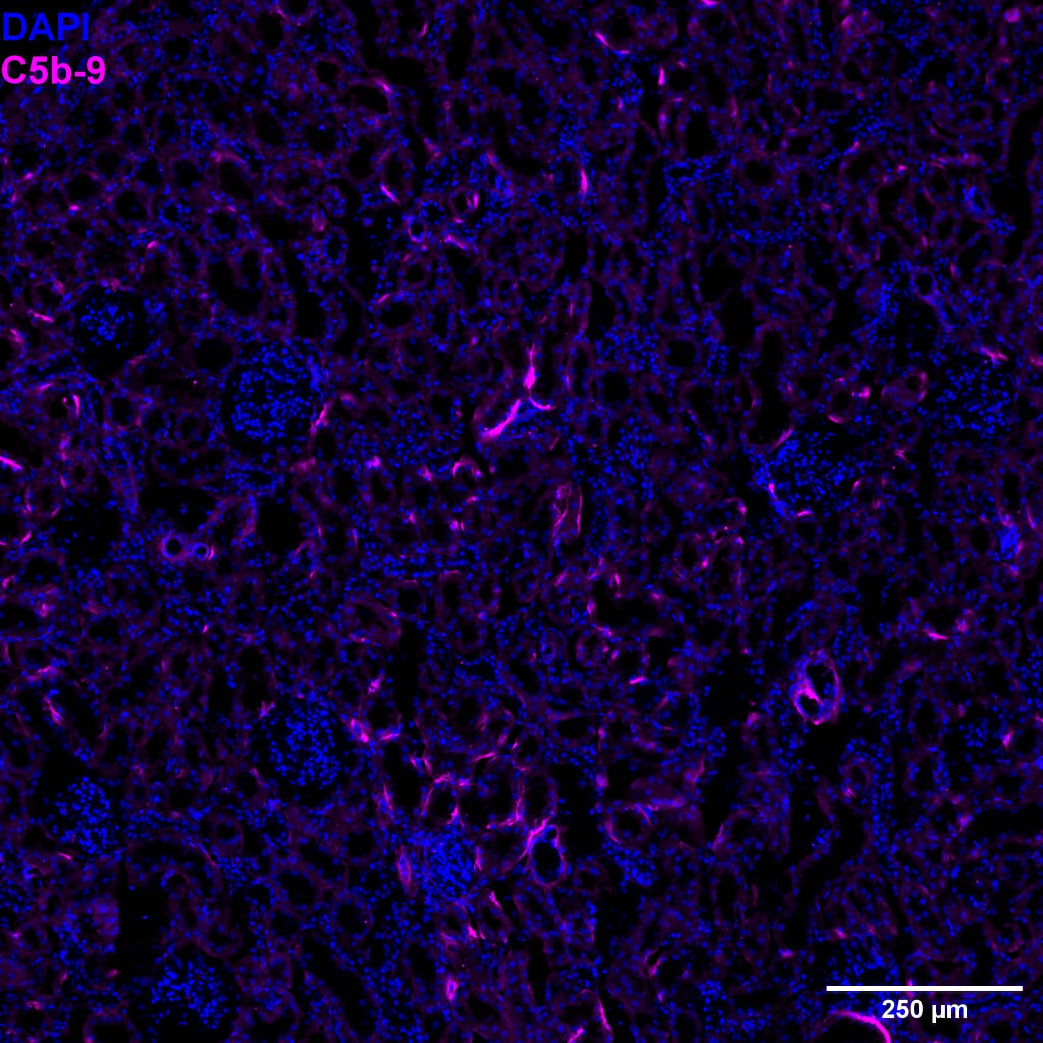 Immunohistochemistry-Frozen: Mouse Monoclonal C5b-9 Antibody (2A1) [NBP2-77377] - LPS injected rat liver tissue. FxFr: 10 µm thickness 1:200. Secondary antibody AF647. Nucleus (Blue, DAPI) and C5b-9 (Magenta). Image from a verified customer review.