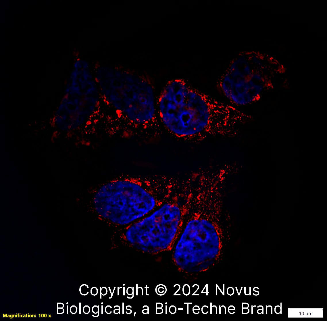 TSG101 was detected in immersion fixed MCF7 human breast cancer cell line using Rabbit anti-TSG101 Antigen Affinity Purified Polyclonal Antibody conjugated to Biotin (Catalog # NBP2-77452B) at 5 µg/mL overnight at 4C. Cells were stained using Streptavidin conjugated to DyLight 550 (red) and counterstained with DAPI (blue). Cells were imaged using a 100X objective and digitally deconvolved. 