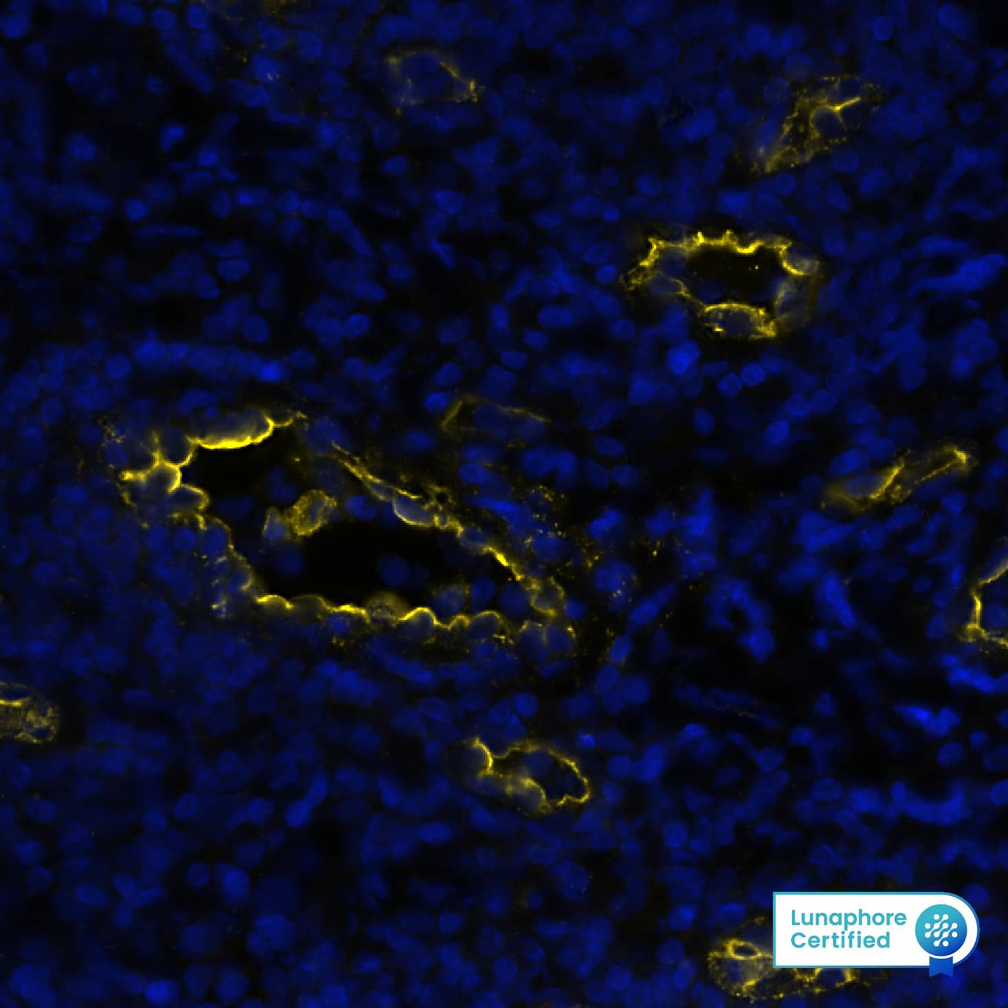 Peripheral Node Addressin was detected in immersion fixed paraffin-embedded sections of human Tonsil using Rat Anti-Human Peripheral Node Addressin (MECA-79R), Monoclonal Antibody (Catalog #NBP2-78792) at 1:50 dilution at 37° Celsius for 4 minutes. Before incubation with the primary antibody, tissue underwent an all-in-one dewaxing and antigen retrieval preprocessing using PreTreatment Module (PT Module) and Dewax and HIER Buffer H (pH 9; Epredia Catalog # TA-999-DHBH). Tissue was stained using the Alexa Fluor™ 647 Goat anti-Rat IgG Secondary Antibody at 1:200 at 37 ° Celsius for 2 minutes. (Yellow; Lunaphore Catalog # DR647RT) and counterstained with DAPI (blue; Lunaphore Catalog # DR100). Specific staining was localized to endothelial cells. Protocol available in COMET™ Panel Builder.