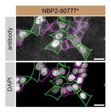 HAP1 WT and hnRNP A2B1 KO cells were labelled with a green or a far-red fluorescent dye, respectively. Cells were stained with hnRNP A2B1 antibody and with the corresponding Alexa-fluor 555 coupled secondary antibody including DAPI. Acquisition of the blue (nucleus-DAPI), green (identification of WT cells), red (antibody staining) and far-red (identification of KO cells) channels was performed. Representative images of the blue and red (grayscale) channels are shown. WT and KO cells are outlined with green and magenta dashed line, respectively. Antibody dilution used: 1/1000. Image, protocol and testing courtesy of YCharOS Inc. (ycharos.com).