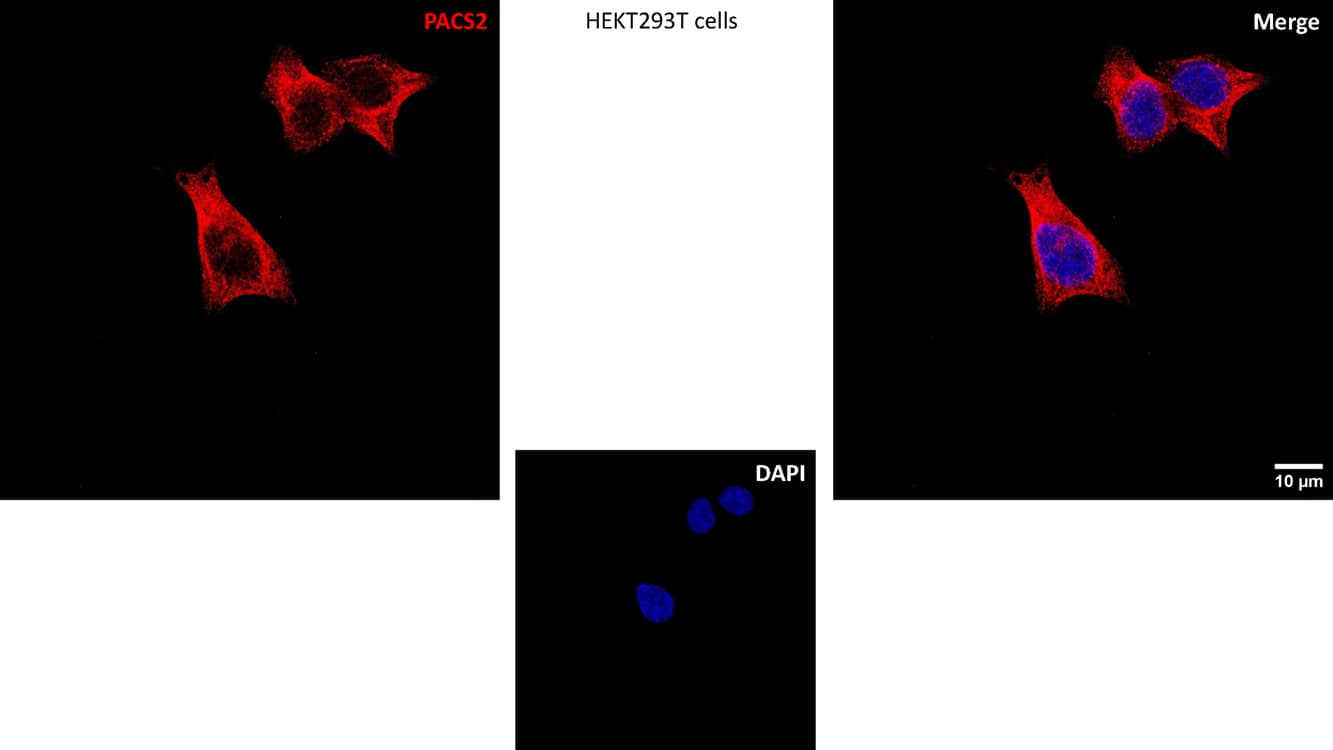 HEK293T cells were seeded and fixed with 4% PFA. The primary antibody for IF was used at a dilution ratio of 1:50. Image from a verified customer review. The customer used the AF488-conjugated version of NBP2-81975, which is listed under NBP2-81975AF488