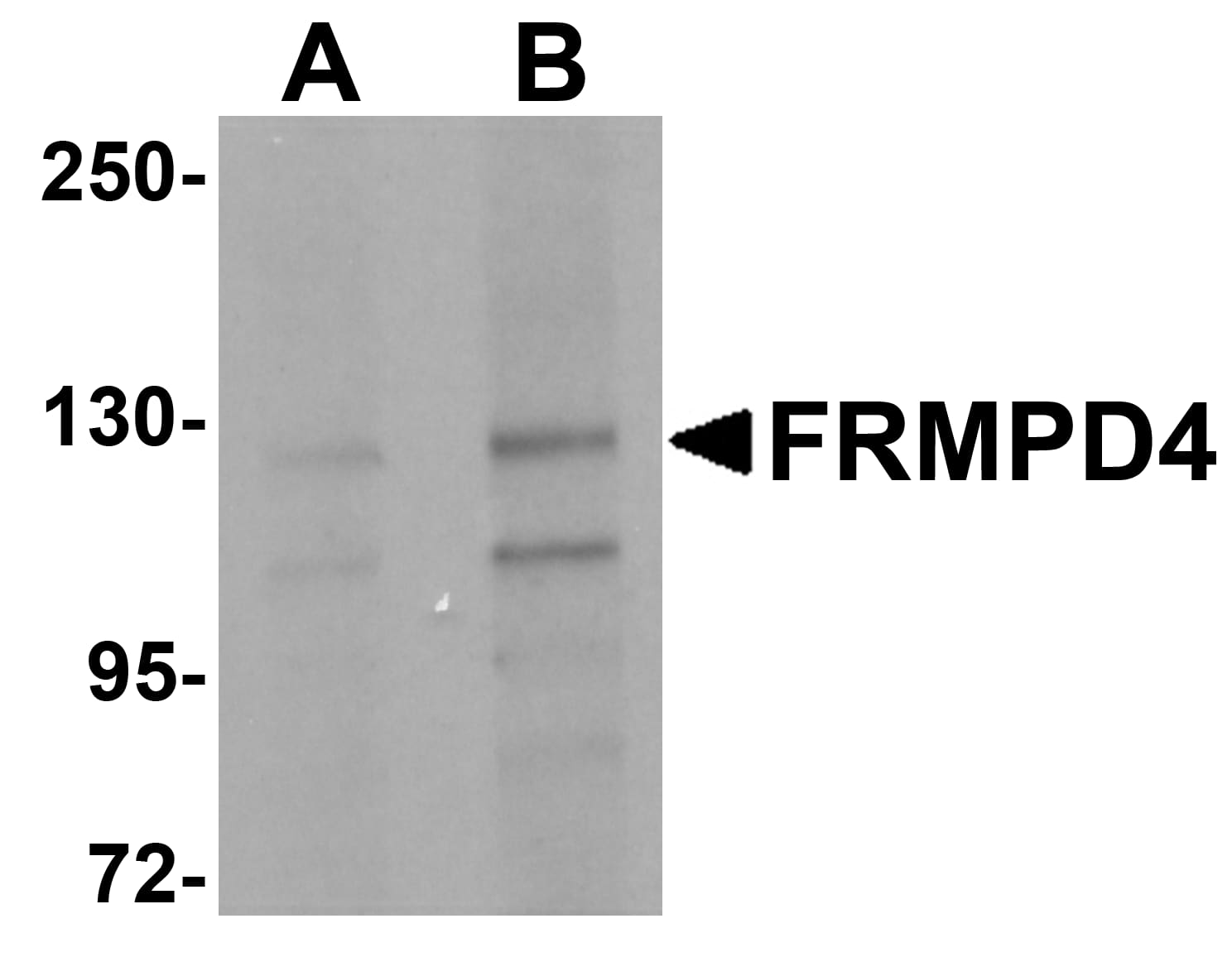 Western Blot: Preso/FRMPD4 Antibody [NBP2-82035] - Analysis of FRMPD4 in SK-N-SH cell lysate with FRMPD4 antibody at (A) 1 and (B) 2 ug/ml.