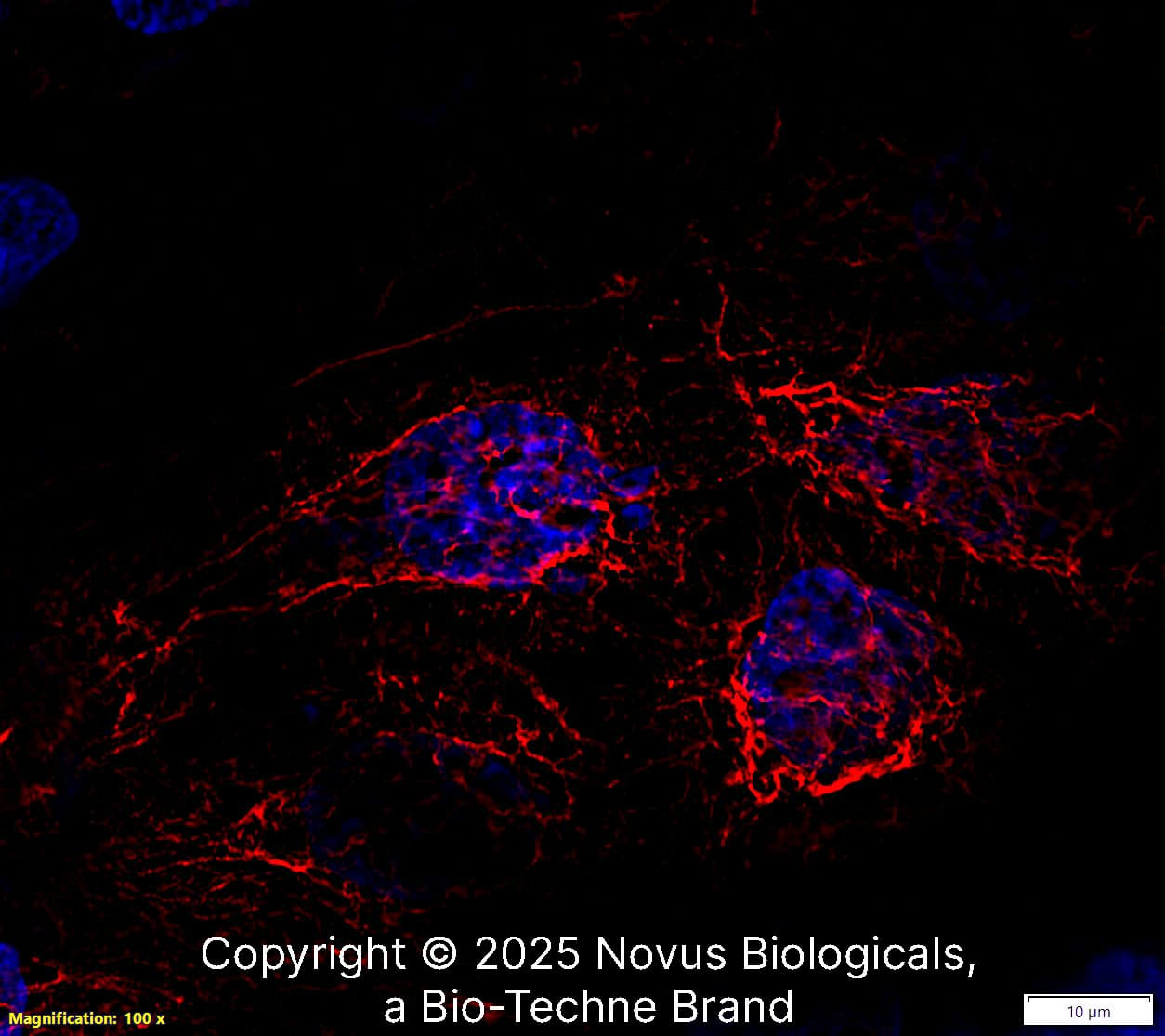 Cytokeratin 5 (CL9297) was detected in immersion fixed A431 human skin carcinoma cell line using Mouse anti-Cytokeratin 5 (CL9297) Protein A Purified Monoclonal Antibody conjugated to DyLight 550 (Catalog # NBP2-88923) (red) at 2 µg/mL overnight at 4C. Cells were counterstained with DAPI (blue). Cells were imaged using a 100X objective and digitally deconvolved.