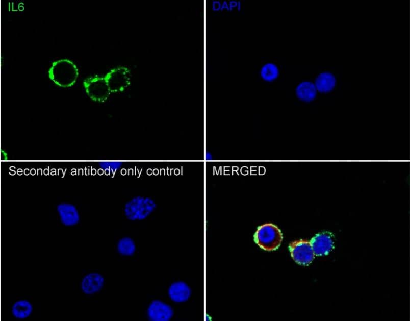 Immunocytochemistry/Immunofluorescence: IL-6 Antibody (1-6) [NBP2-89149] -  Analysis of EL4 cells labeling IL-6 with Rabbit anti-IL-6 antibody at 1/1,000 dilution.Cells were fixed in 4% paraformaldehyde for 20 minutes at room temperature, permeabilized with 0.1% Triton X-100 in PBS for 5 minutes at room temperature, then blocked with 1% BSA in 10% negative goat serum for 1 hour at room temperature. Cells were then incubated with Rabbit anti-IL-6 antibody at 1/1,000 dilution in 1% BSA in PBST overnight at 4 ℃. Goat Anti-Rabbit IgG H&L (iFluor™ 488,) was used as the secondary antibody at 1/1,000 dilution. PBS instead of the primary antibody was used as the secondary antibody only control. Nuclear DNA was labelled in blue with DAPI.Beta tubulin (red) was stained at 1/100 dilution overnight at +4℃. Goat Anti-Mouse IgG H&L (iFluor™ 594, HA1126) was used as the secondary antibody at 1/1,000 dilution.