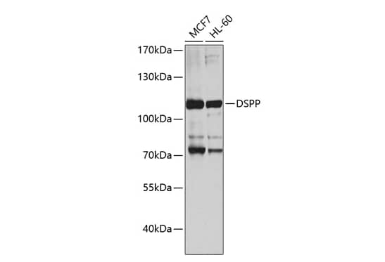 Western Blot DSPP Antibody - BSA Free