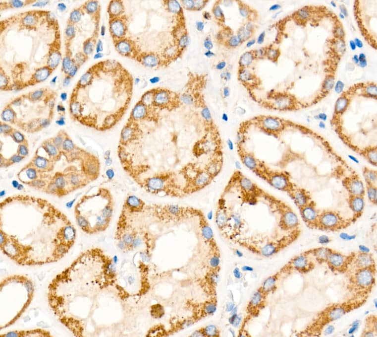  Analysis of paraffin-embedded Human kidney tissue using TIMM23 Rabbit pAb at a dilution of 1:1000 (40x lens). High pressure antigen retrieval performed with 0.01M Tris-EDTA Buffer (pH 9.0) prior to IHC staining.