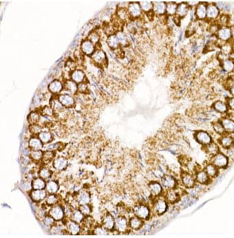 Immunohistochemistry-Paraffin: MT-ND4 Antibody [NBP2-93530] -Analysis of Rat ovary using MT-ND4 Rabbit pAb at dilution of 1:200 (40x lens).Perform high pressure antigen retrieval with 10 mM citrate buffer pH 6.0 before commencing with IHC staining protocol.