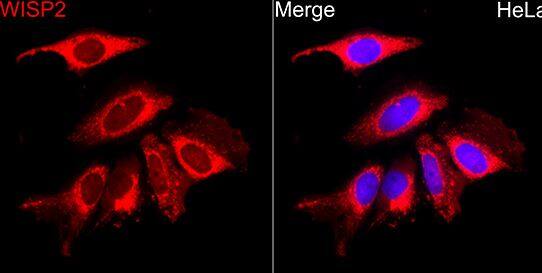 ICC/IF-WISP2 Antibody [NBP2-93612] -  HeLa cells using WISP2 Rabbit pAb at dilution of 1:100 (40x lens). Secondary antibody: Cy3 Goat Anti-Rabbit IgG (H+L) at 1:500 dilution. Blue: DAPI for nuclear staining.