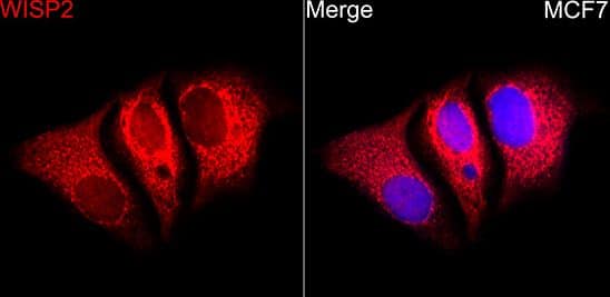 ICC/IF-WISP2 Antibody [NBP2-93612] - MCF7 cells using WISP2 Rabbit pAb at dilution of 1:100 (40x lens). Secondary antibody: Cy3 Goat Anti-Rabbit IgG (H+L) at 1:500 dilution. Blue: DAPI for nuclear staining.