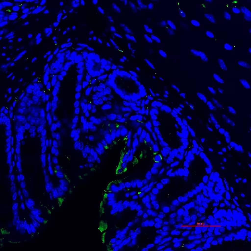 Immunohistochemistry-Paraffin: Rabbit Polyclonal Reg3G Antibody [NBP2-93737] - Green-Reg3G, Blue-DAPI in colon distal section. Primary antibody dilution used was 1:500. Image from a verified customer review.