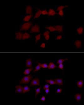 ICC/IF-NGLY1 Antibody [NBP2-94289] - Analysis of PC-12 cells using NGLY1 Rabbit pAb (A15864) at dilution of 1:50 (40x lens). Blue: DAPI for nuclear staining.