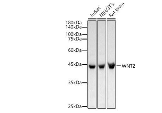 Western Blot: Wnt-2 Antibody [NBP2-94468] - analysis of various lysates, using WNT2 antibody at 1:800 dilution.Secondary antibody: HRP Goat Anti-Rabbit IgG (H+L) at 1:10000 dilution.Lysates/proteins: 25ug per lane.Blocking buffer: 3% nonfat dry milk in TBST.Detection: ECL Basic Kit. Exposure time: 10s.