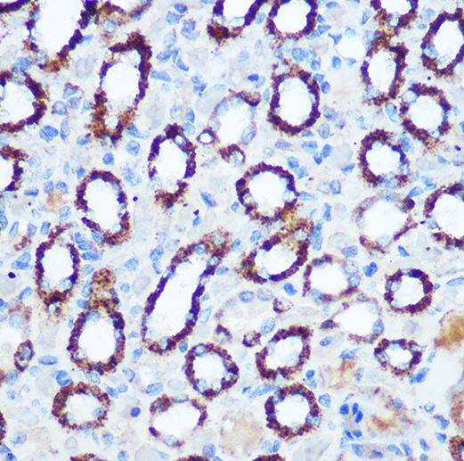 Immunohistochemistry-Paraffin: Pyruvate Dehydrogenase E1-alpha subunit Antibody [NBP2-95253] -Analysis of paraffin-embedded rat kidney using PDHA1 Rabbit pAb at dilution of 1:100 (40x lens).Perform microwave antigen retrieval with 10 mM Tris/EDTA buffer pH 9.0 before commencing with IHC staining protocol.