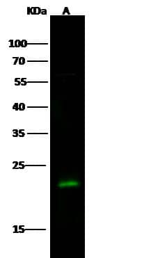 Western Blot: Rab7a Antibody [NBP2-98732] - Lane A: A431 Whole Cell LysateLysates/proteins at 30 ug per lane.SecondaryGoat Anti- Rabbit  IgG H&L (Dylight 800)  at 1/10000 dilution.Developed using the Odyssey technique.Performed under reducing conditions.Predicted band size:23 kDaObserved band size:23 kDa